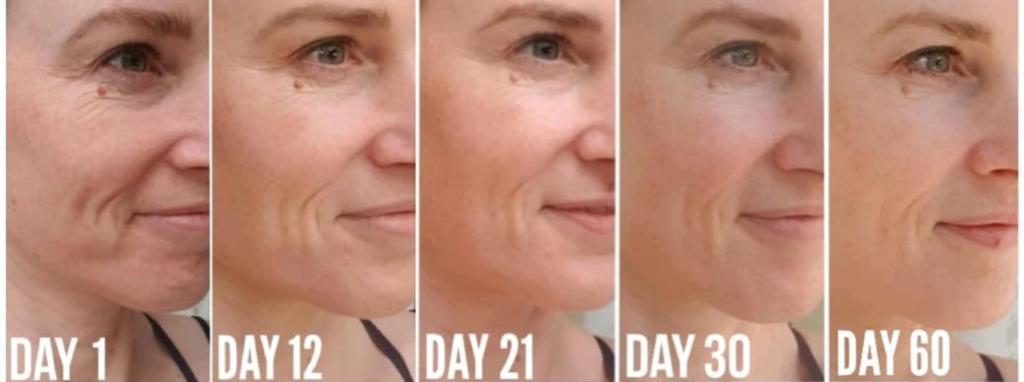 Collagen Before And After Pictures Do You See The Difference 